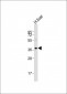 LMX1A Antibody (C-term)