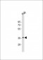 RASSF2 Antibody (N-Term)