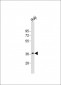 RASSF2 Antibody (N-Term)