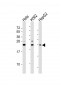 SRY Antibody (N-Term)