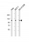 PPP1R13L Antibody (Center)