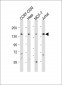 PLCG1 Antibody (Center)