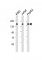 IQSEC2 Antibody (Center)