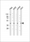 RBMX Antibody (Center)