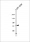 ITK Antibody (N-term)