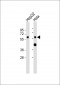 CYP7A1 Antibody (N-term)