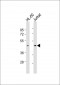 IHH Antibody (C-term)