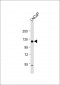 JAG1 Antibody (C-term)