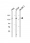 FANCD2 Antibody (Center)