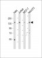 PLCG1 Antibody (Center)