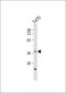 CTSV Antibody (N-Term)