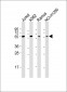 FOXO4 Antibody (Center)