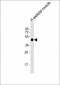 AGPHD1 Antibody (N-Term)