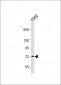 RBBP5 Antibody (C-term)