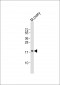 NDUFB7 Antibody (N-term)