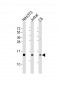 PFN1 Antibody (C-term)