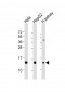 PFN1 Antibody (C-term)