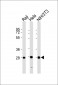 PSMB7 Antibody (Center)