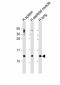 CCL17 Antibody