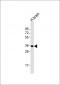 ANKRD54 Antibody (N-term)