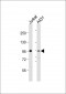 NCSTN Antibody (N-Term)