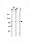 NCSTN Antibody (N-Term)