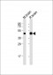 CNP Antibody (N-Term)