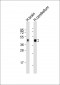 CNP Antibody (C-Term)