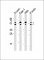 CDKL3 Antibody (N-Term)