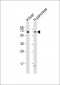 GCKR Antibody (N-Term)