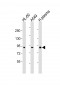 F2 Antibody (N-Term)