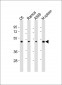 CSK Antibody (N-term)