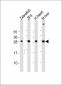 Zebrafish ak2 Antibody (Center)