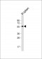 Mouse Srms Antibody (Center)