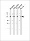 Lck Antibody (Center)