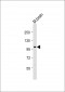 Mouse Csf1r Antibody (P909)