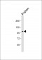 Mouse Ptk2b Antibody (P851)