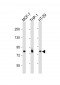 IRAK1 Antibody (C-term)