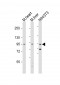 Mouse Insr Antibody (P1325)
