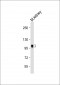 Mouse Insr Antibody (P1325)