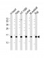 HIST3H2A Antibody (N-term)