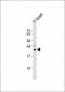 GSTK1 Antibody (N-term)