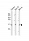 CYB5A Antibody (Center)