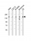 (Mouse) Smarcc1 Antibody (C-term)