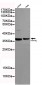 Protein Phosphatase 4C Antibody
