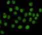 SMC1A(C-term) Antibody