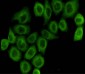 pyruvate dehydrogenase (lipoamide) alpha 1 Antibody