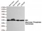 Mannose Phosphate Isomerase Antibody