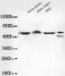 TBLR1 Antibody