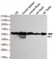 AKT(pan) Antibody